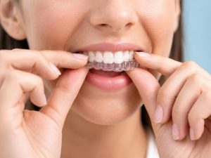 Dental Marketing Channels for High Value Treatments