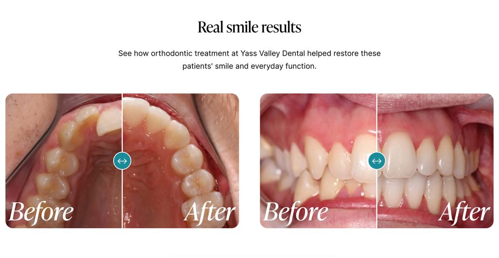 Example of real before-and-after treatment photography used as social proof on a dental website